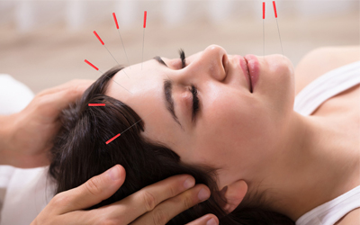 Everything You Need To Know About Acupuncture Treatment