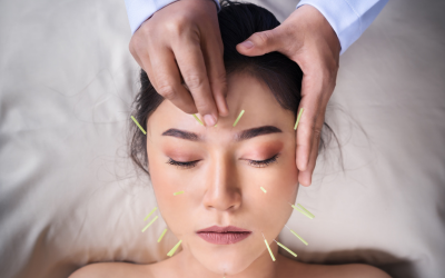 Acupuncture Points and Their Transformative Uses